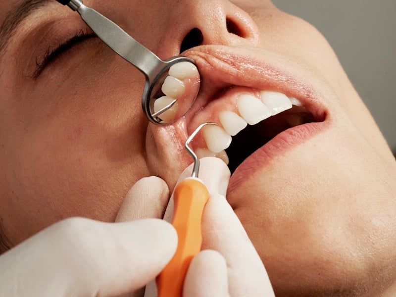 You are currently viewing How to Help Your Child Overcome Dental Anxiety